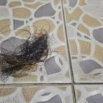 Wisconsin Woman lost her hair due to the use of a conditioner