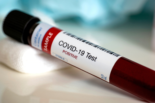  71-year-old man dies while waiting for his COVID-19 test in Utah